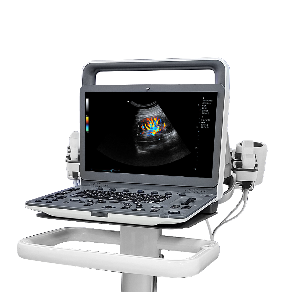 ECÓGRAFO PORTÁTIL 3D/4D M30 - Imagen 4