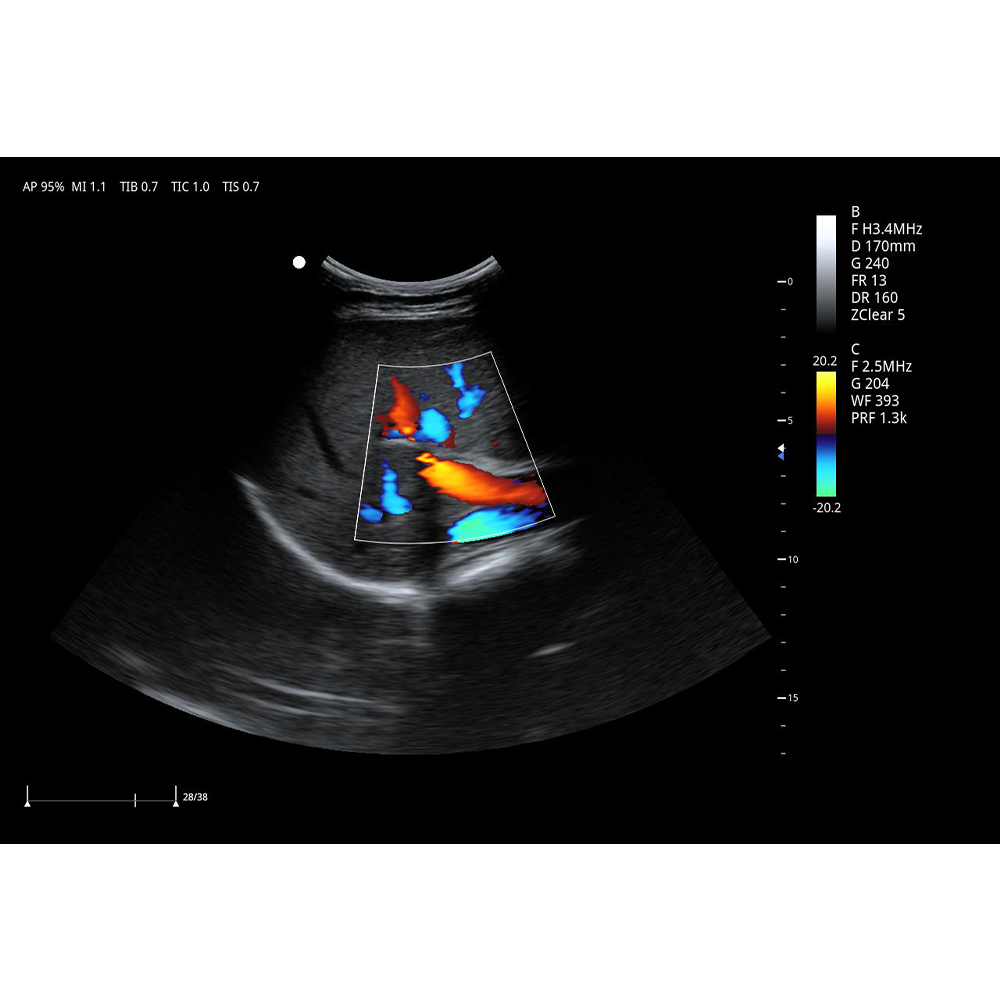 ECÓGRAFO PORTÁTIL 3D/4D M30 - Imagen 3