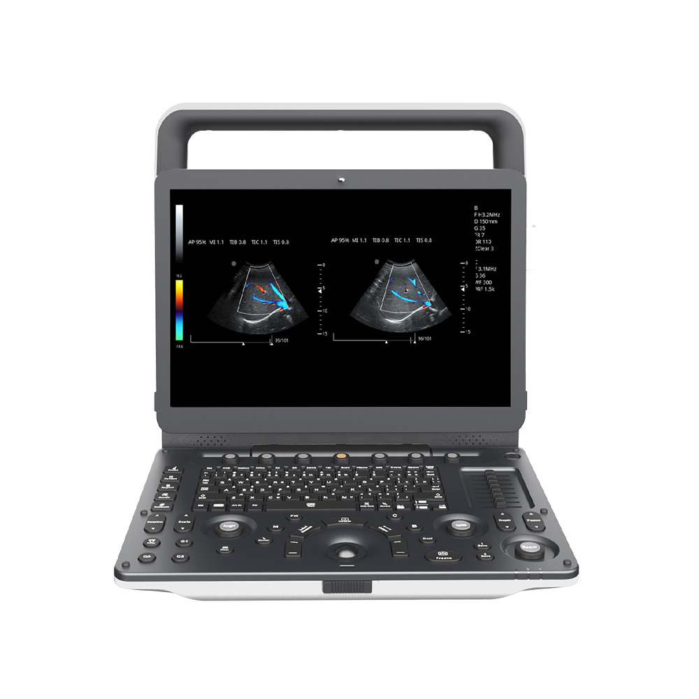 ECÓGRAFO PORTÁTIL 3D/4D M30